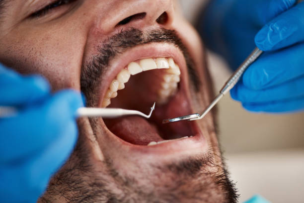 Best Cracked Tooth Emergency Dentist  in Springfield, SD