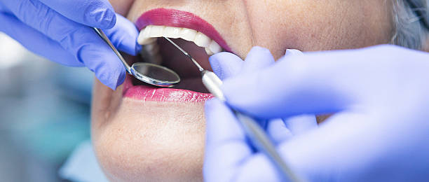 Best Chipped Tooth Repair Near Me  in Springfield, SD